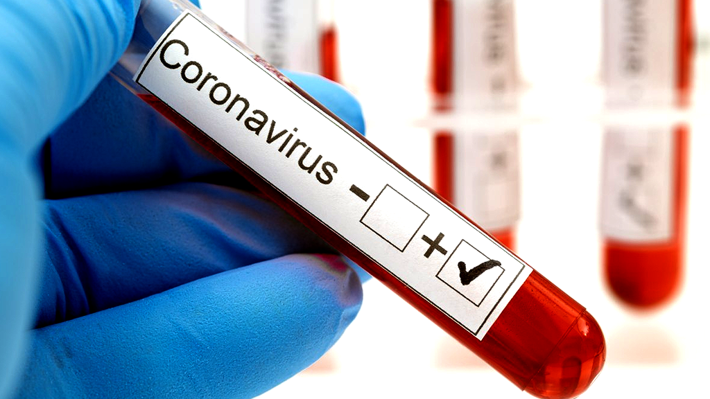 Those who travel to the Dominican Republic must have a negative PCR test